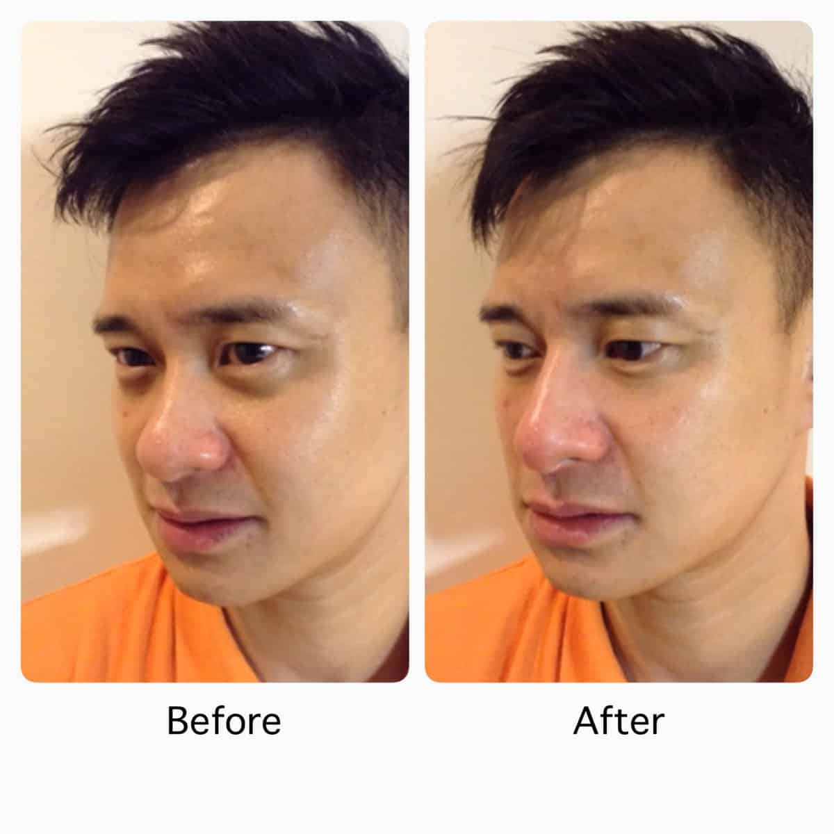 스킨 케어와 라이프 스타일 변화로 만성 어두운 서클을 개선 한 방법